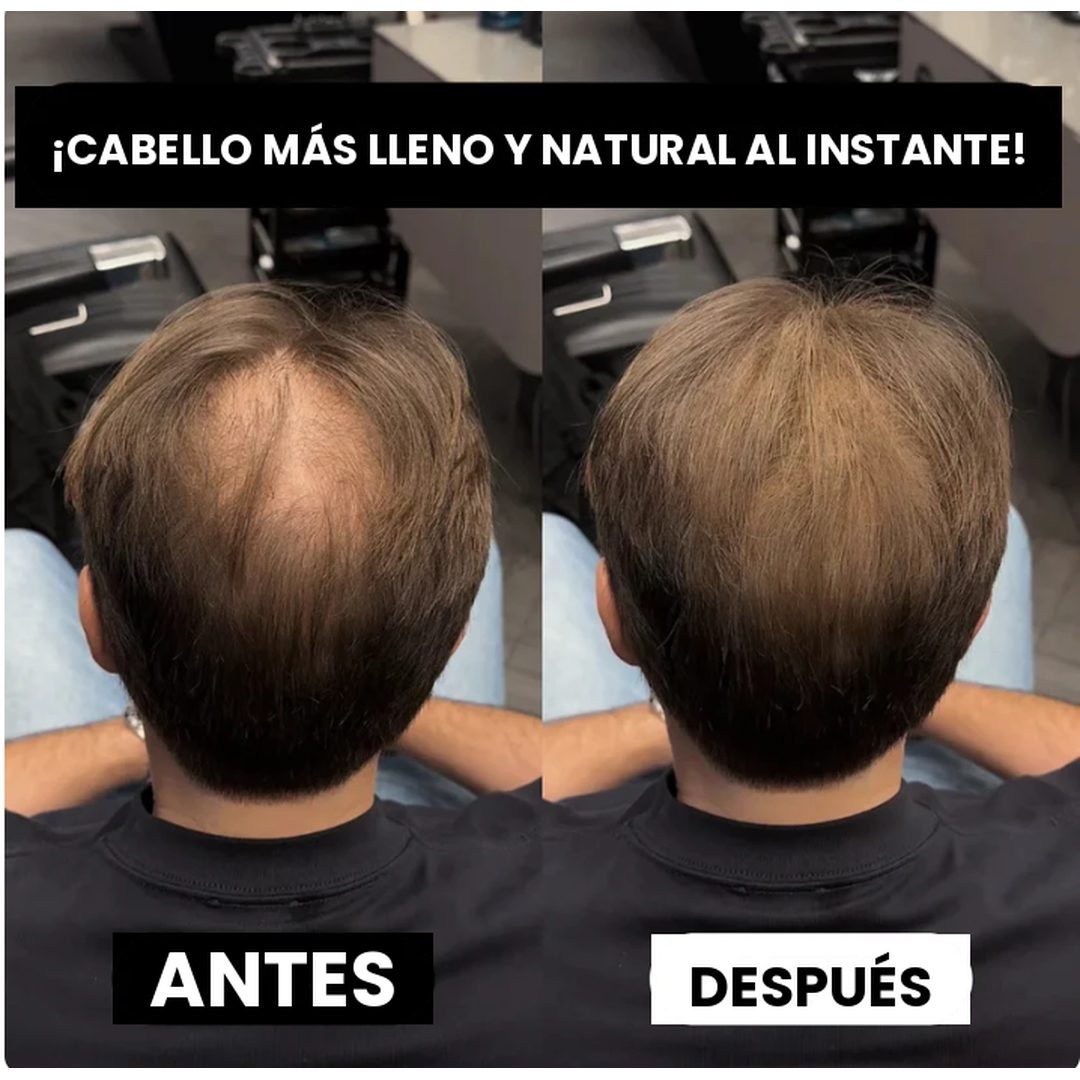 Cielora™ - Volumen Instantáneo